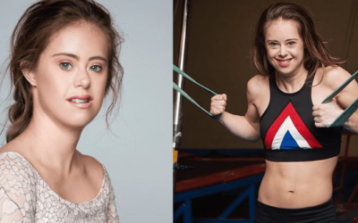 Chelsea Werner, an American champion world gymnast with Down Syndrome becomes a high fashion model