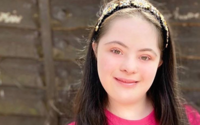 More about Ellie Goldstein, teenage model with Down Syndrome