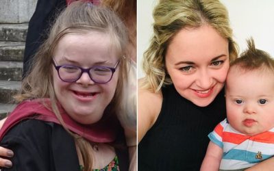 Woman With Down’s Syndrome Landmark Case Against UK Government Over Discriminatory Abortion Law To Be Heard By High Court