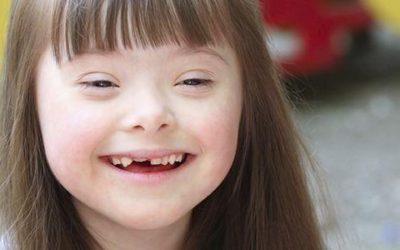 Trisomy 21 Success Story: Mila